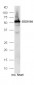 DDX19A Polyclonal Antibody